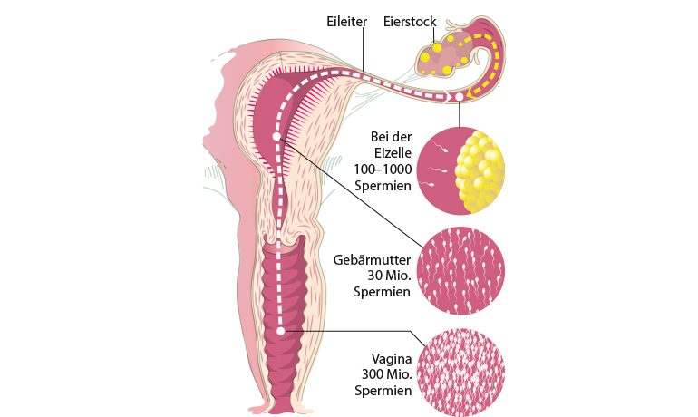 Querschnitt einer Vagina