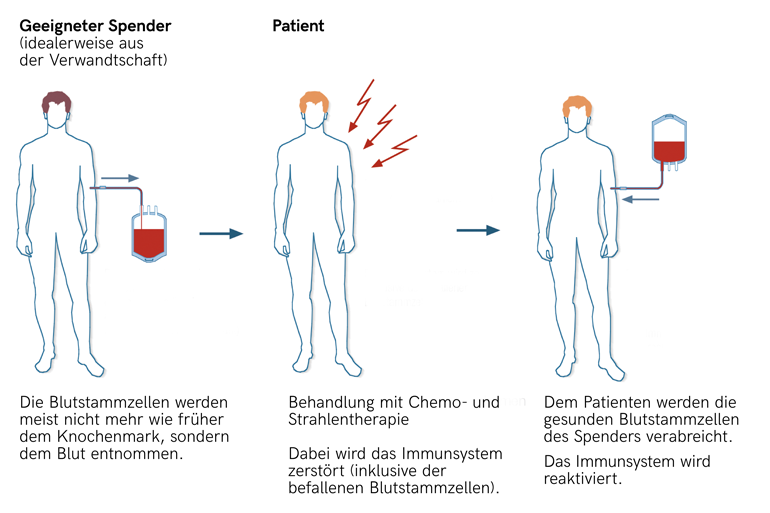 Stammzellspende